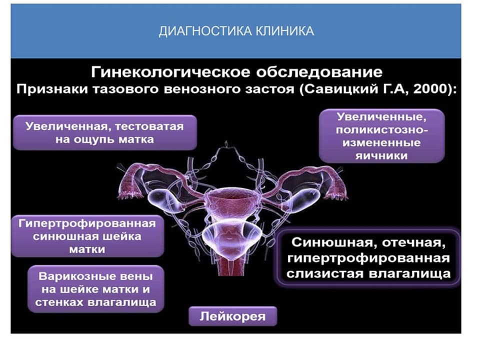 Хроническая тазовая боль презентация